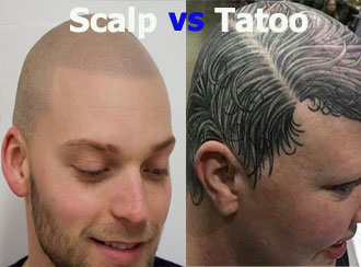 مقایسه اسکالپ و تاتو