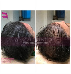 اسکالپ آقایان