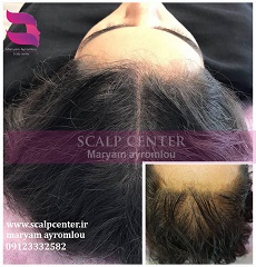 اسکالپ خانم ها