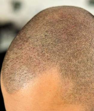 اسکالپ اسپُرت