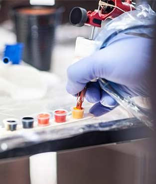 ترمیم هاله سینه 