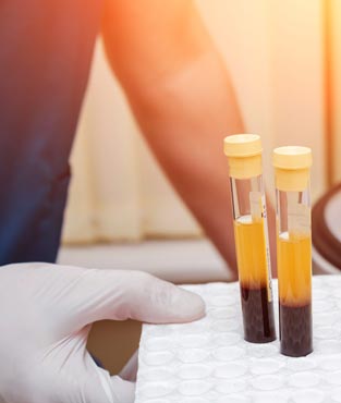 پی آر پی پوست