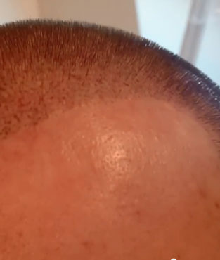 اسکالپ سه بعدی