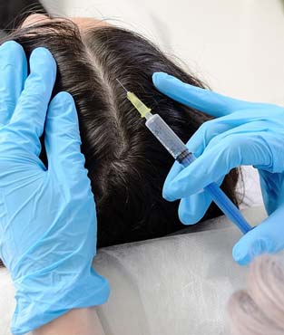 مزوتراپی مو