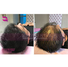 ویدئو نمونه کار اسکالپ آقایان