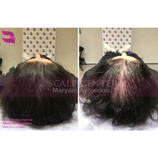 ویدئو نمونه کار اسکالپ خانم ها