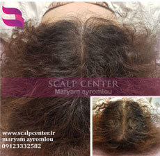 ویدئو اسکالپ